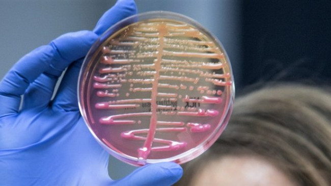 “Klebsiella pneumoniae” bakterisi antibiyotiklere karşı direnç kazanacak