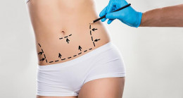 Liposuction sonrasında iyileşme süreci nasıl olmalı?